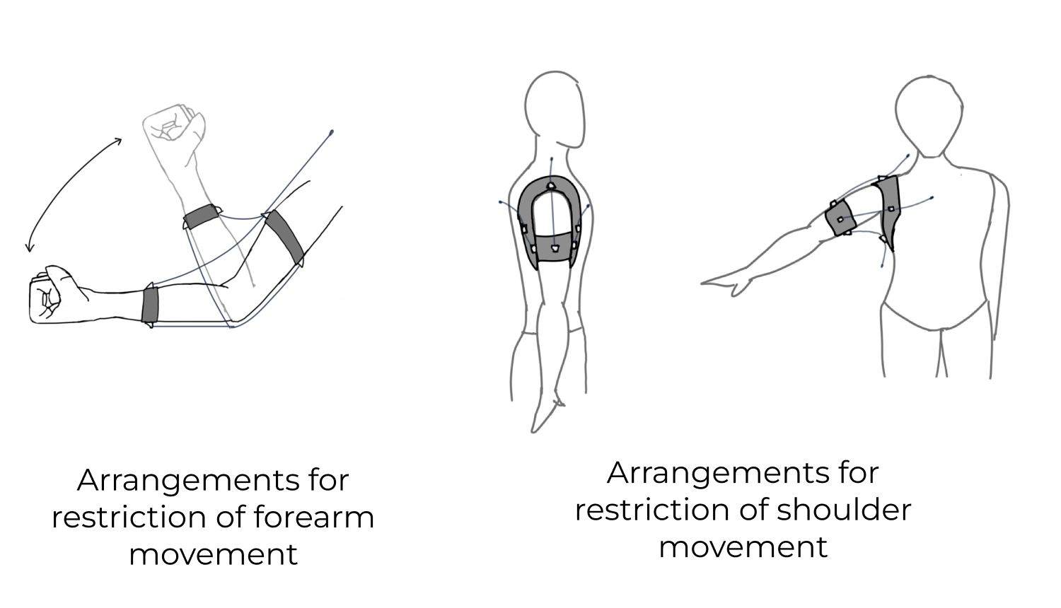 Shoulder link arrangement, front